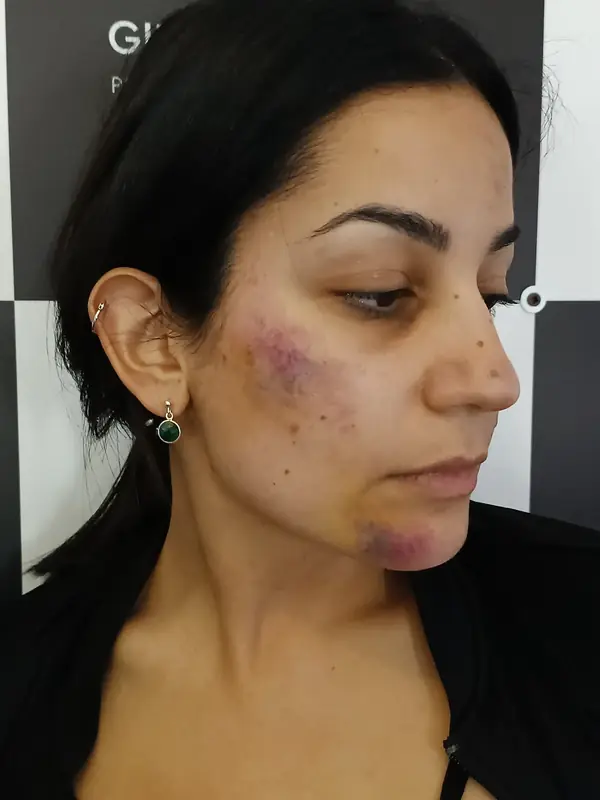 Trucco cinematografico ed effetti speciali nel Salento — Miriam Imbrogno Make-up Artist (25)